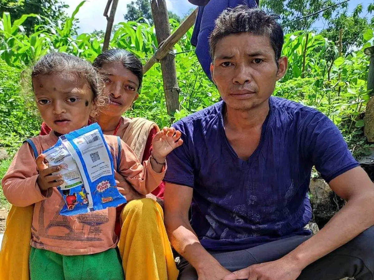 भुवनको उपचारका लागि १ लाख २९ हजार रकम संकलन, काठमाण्डौंमा उपचार हुँदै 